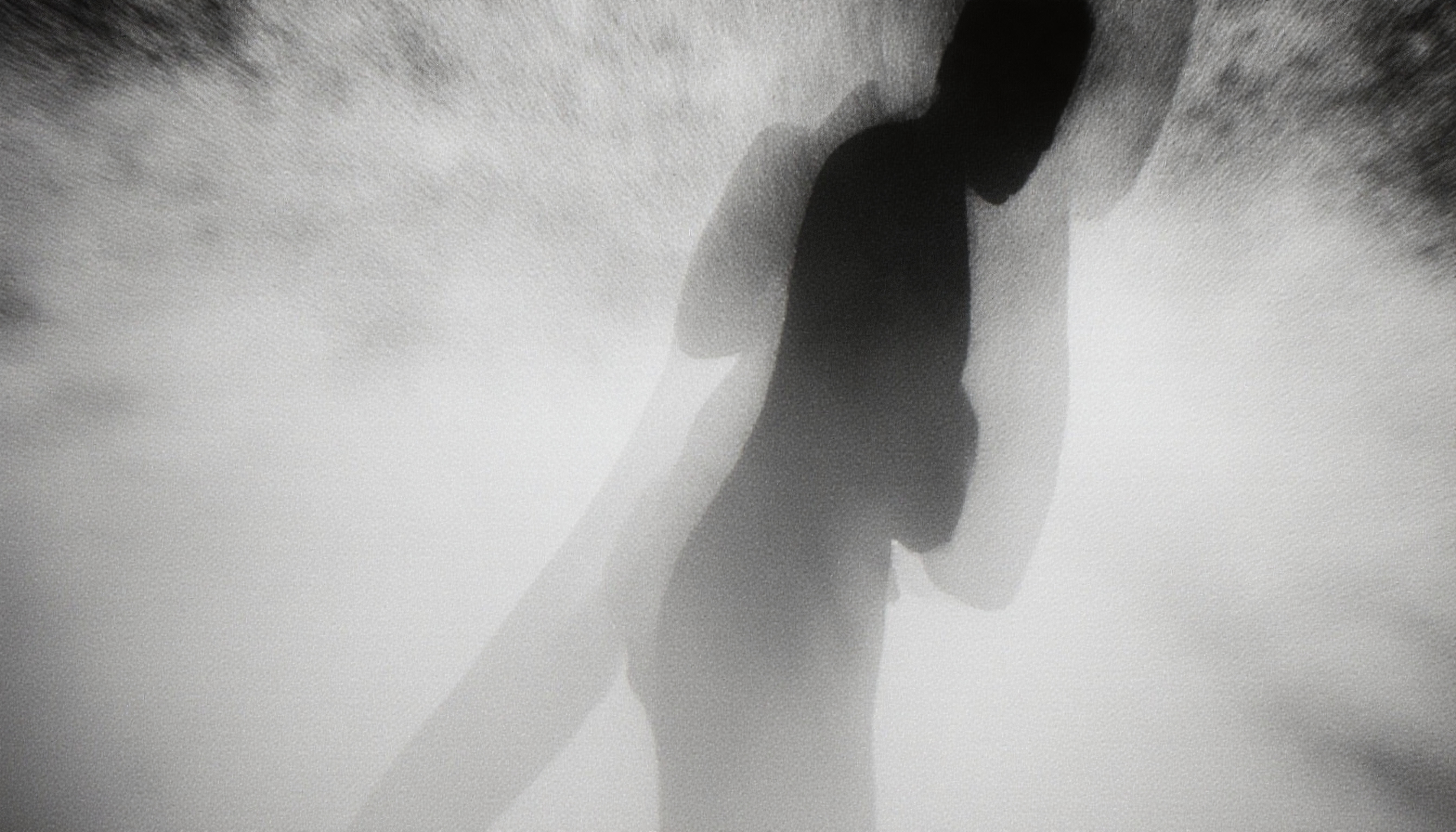 Silhouetted Figure Amidst Textured Fog